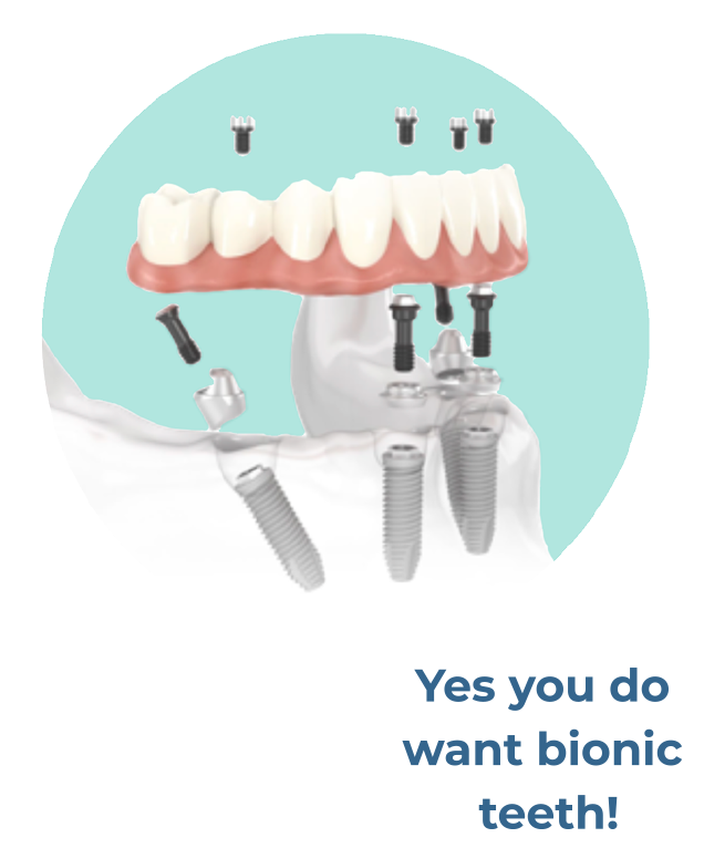 Yes you do want bionic teeth!