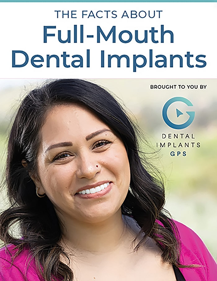 Full Mouth Dental Implants