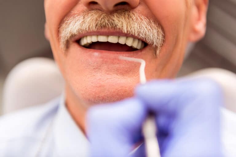 Can Seniors Get Full Mouth Dental Implants? Benefits, Costs, And What To Expect