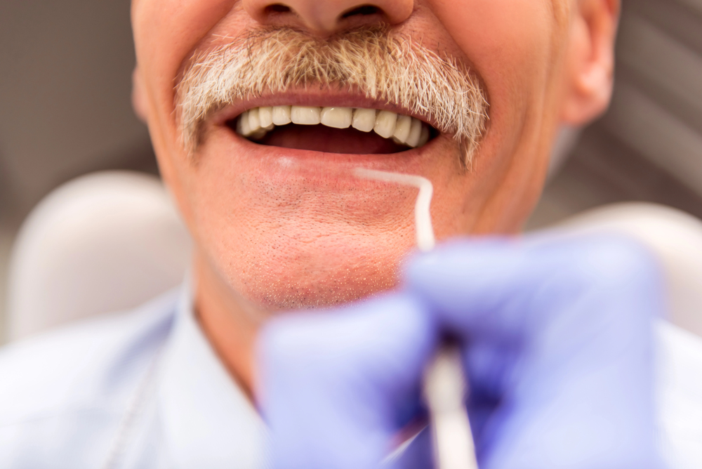 Can Seniors Get Full Mouth Dental Implants? Benefits, Costs, And What To Expect