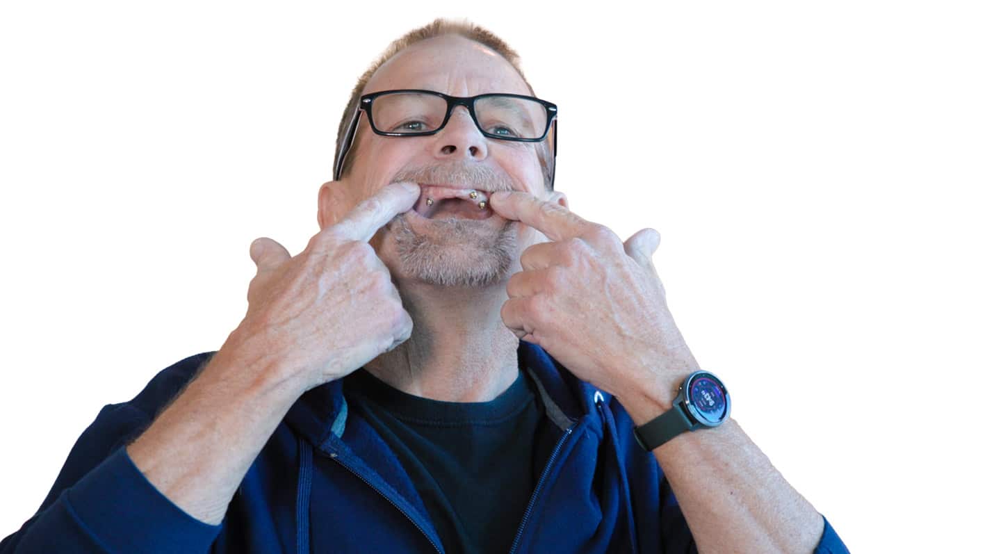 Don came to GPS with a botched implant case.