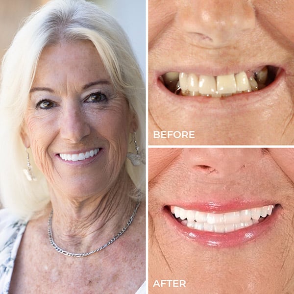 Jeanie - Before and After
