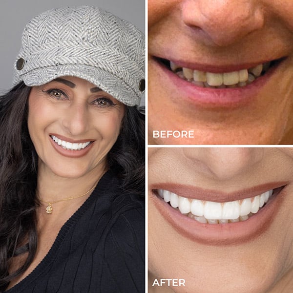 Patricia - Before and After