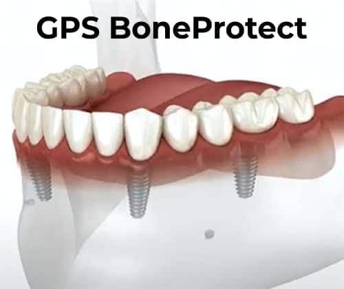Illustration of GPSProtect