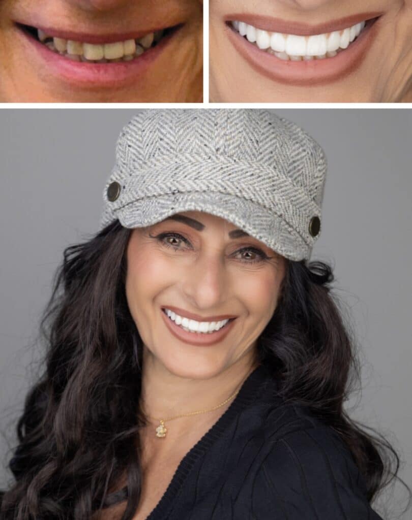 Patient Patricia before and after images