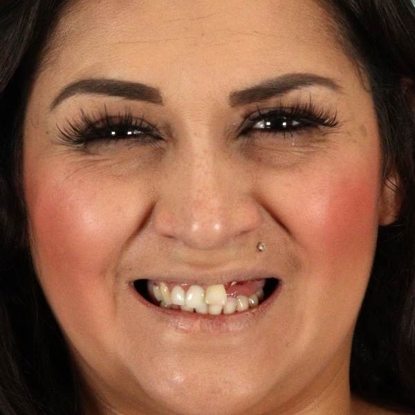 Catherine - GPS Patient